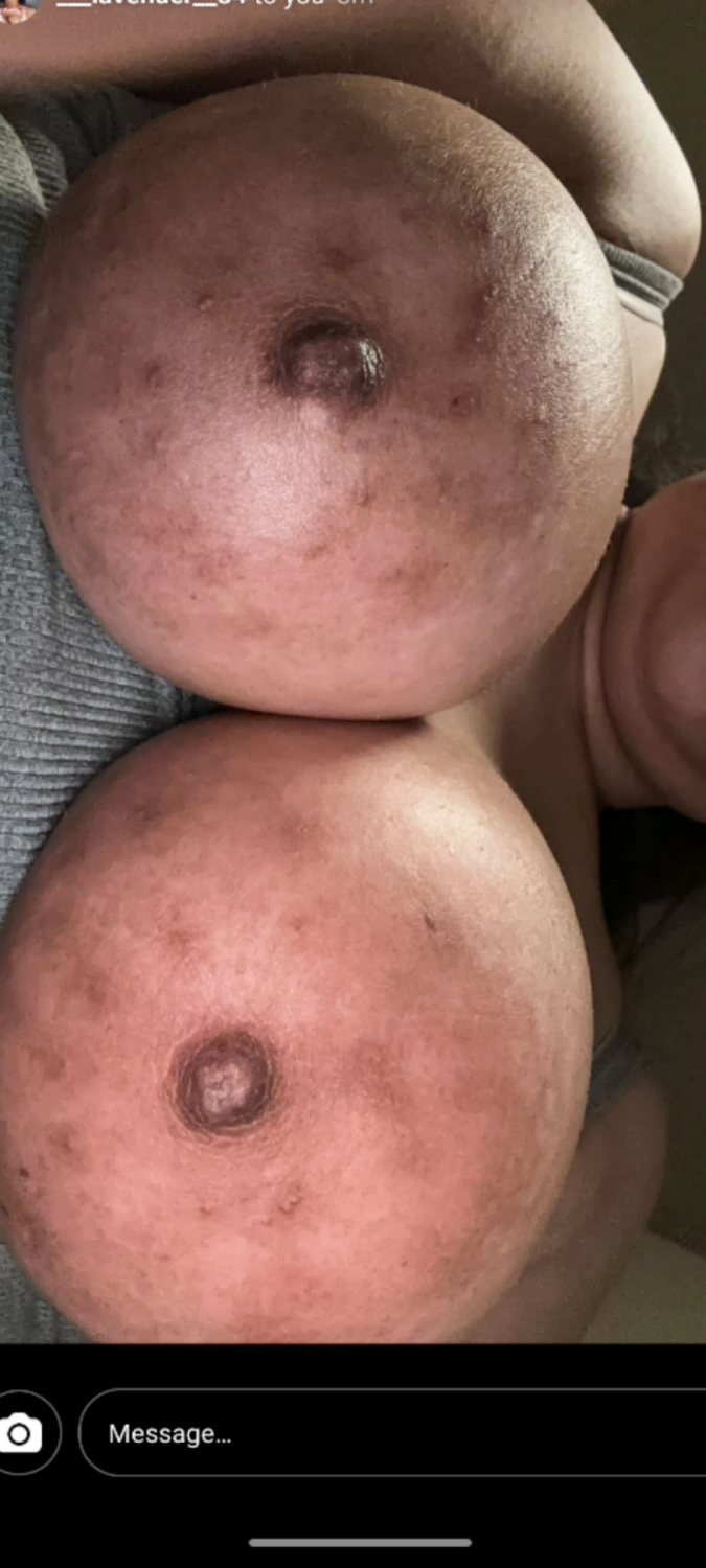 Pakistan Teen W Large Areolas - Porn Videos & Photos - EroMe